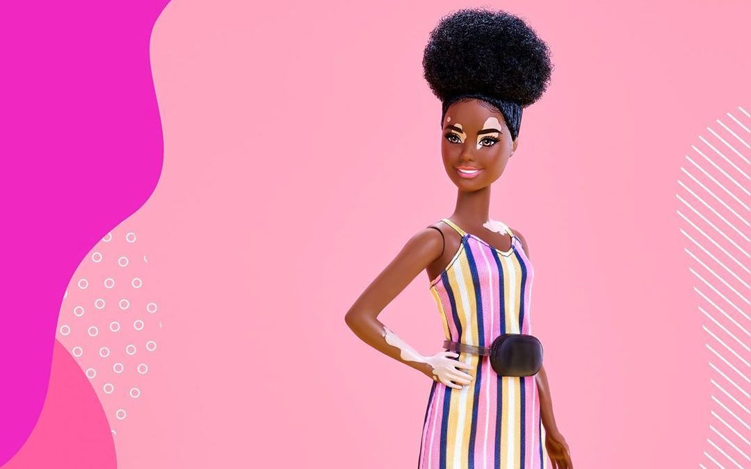 ¡Ver para creer! Mattel lanzó Barbie con vitíligo y hasta una en sillas de ruedas