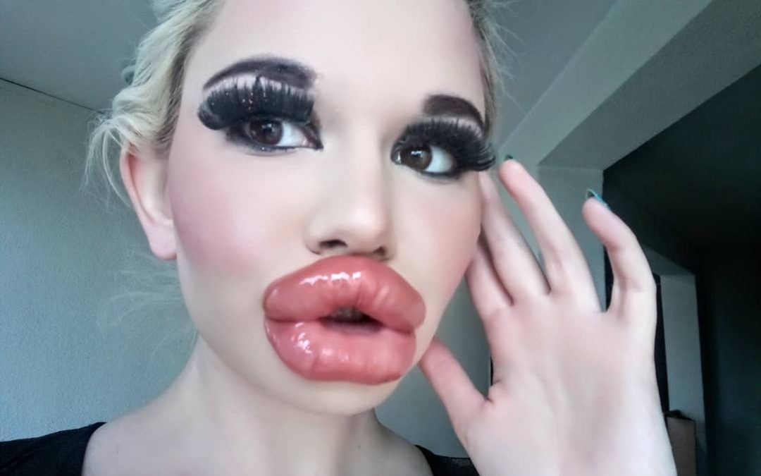 ¡DESCOMUNAL! Se ha inyectado los labios 15 veces y piensa seguir haciéndolo (FOTOS)